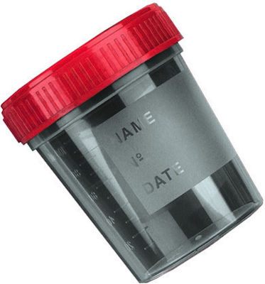 ΔΟΧΕΙΟ ΟΥΡΩΝ ΑΠΟΣΤΕΙΡΩΜΕΝΟ 100ML ME ΕΠΙΦΑΝΕΙΑ ΕΓΓΡΑΦΗΣ ΣΤΟΙΧΕΙΩΝ